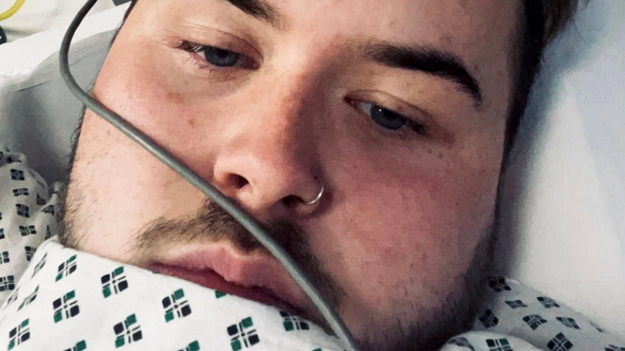 Man was facing year to live at 21 after using sunbeds five times a week