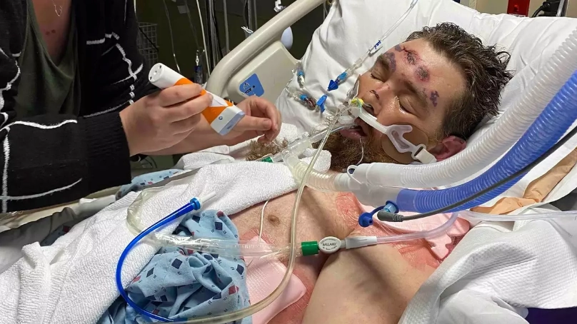 Update on man who was left in coma and given 4% chance of survival after pulling out ingrown hair