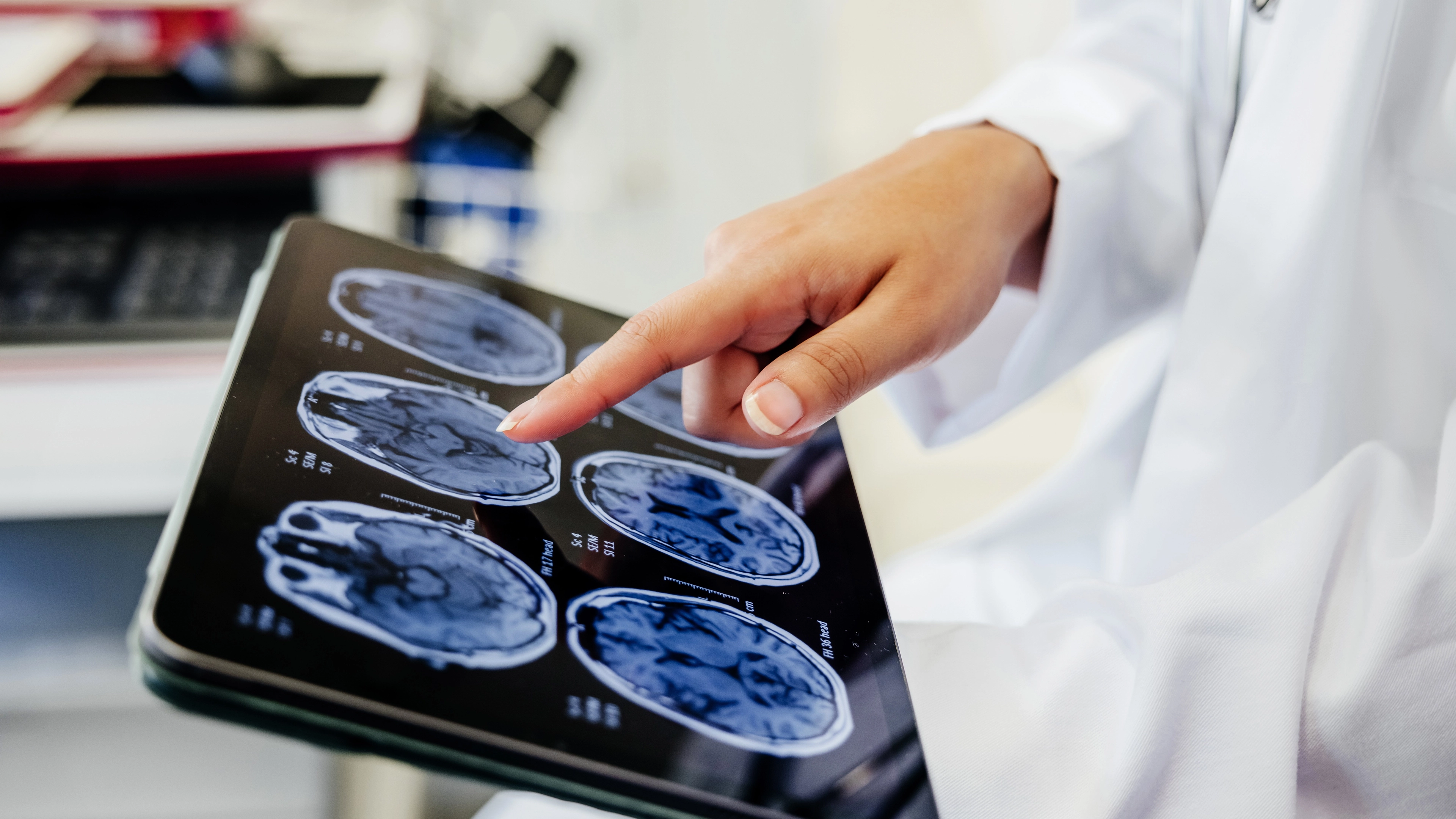 These six personality changes could be signs of early onset dementia