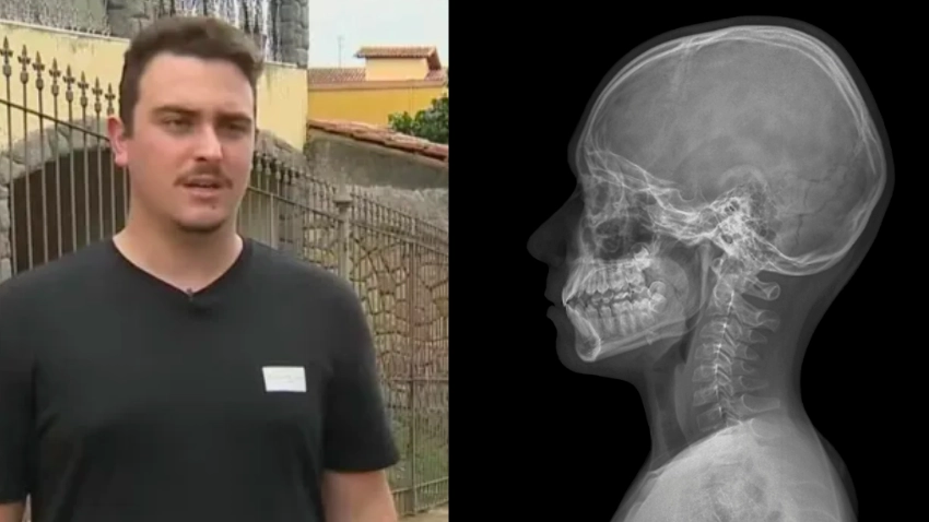 Bloke continued to party for four days after being shot in the head without realising