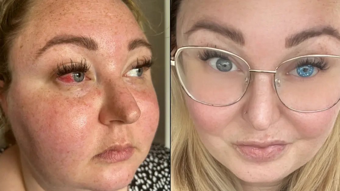 Woman who began coughing up blood was told her 'eyeball could explode' before receiving devastating diagnosis