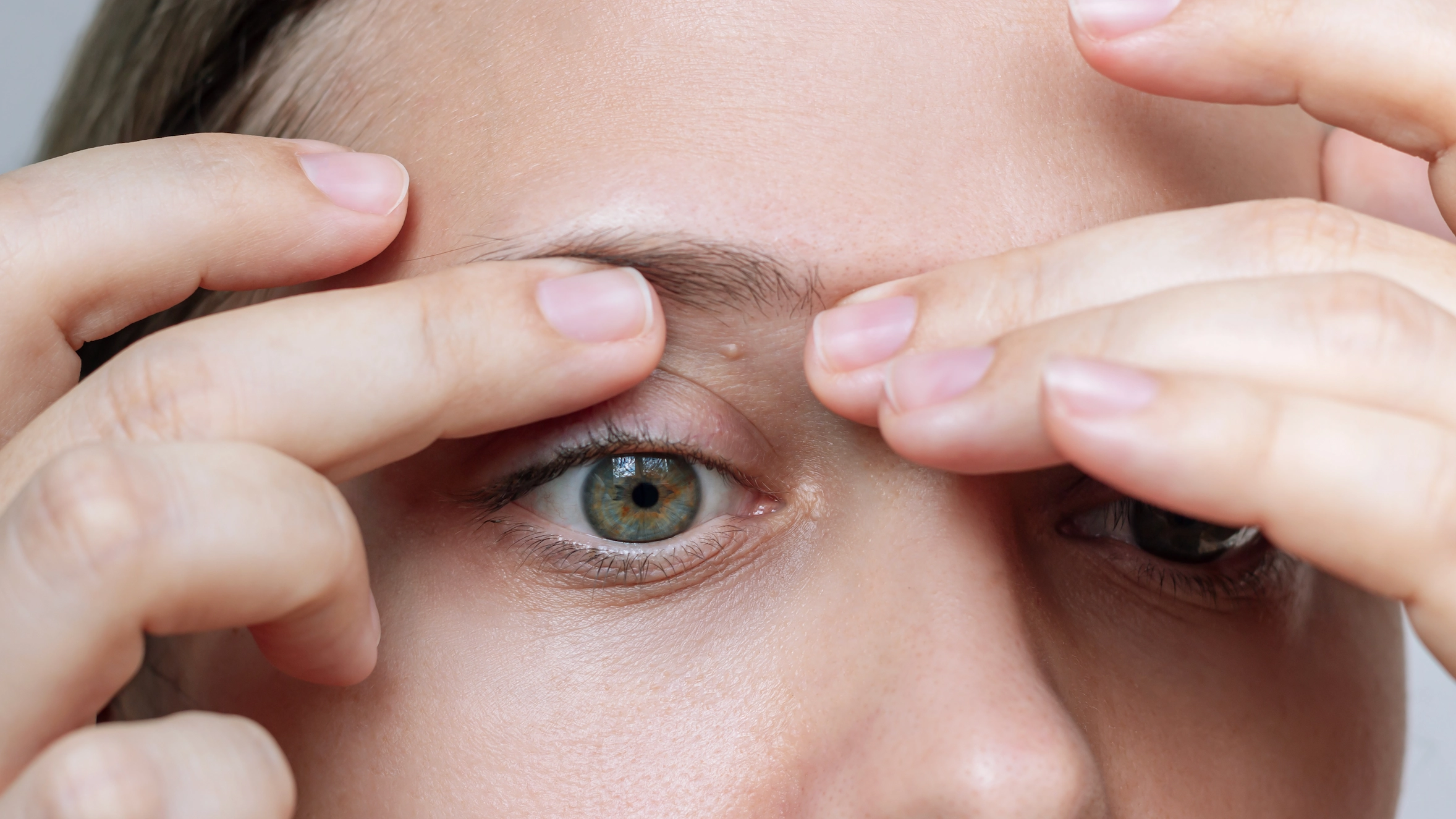 Meaning behind series of white spots you can find all over your body including private parts
