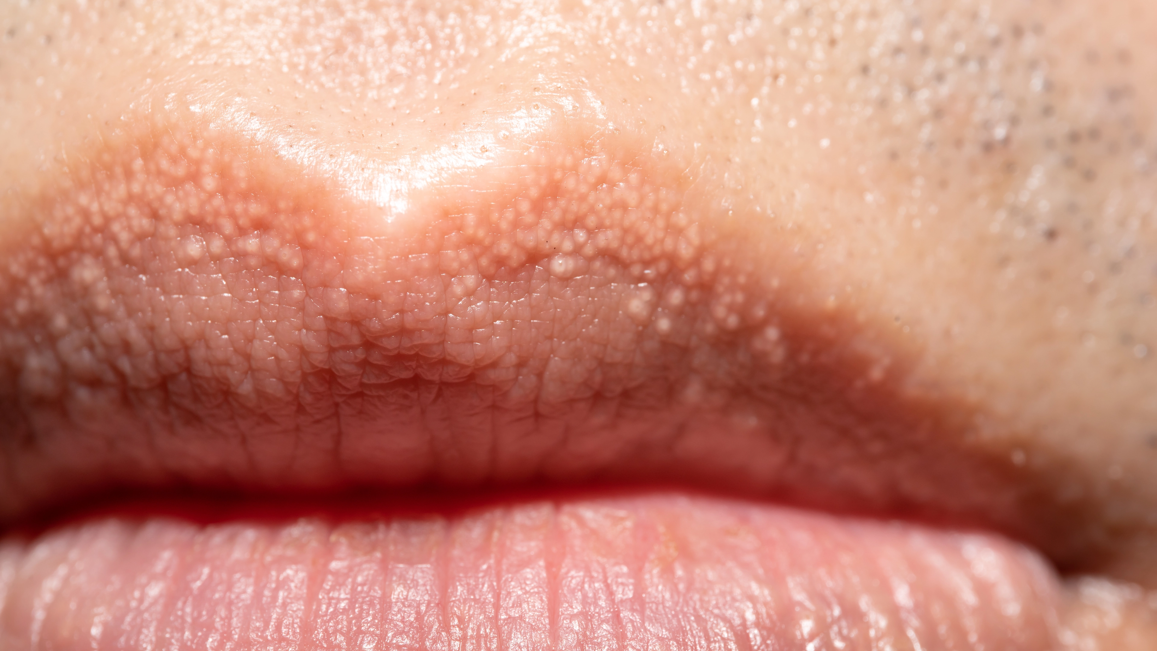 How to know when strange white bumps on body are harmless or could be something more serious