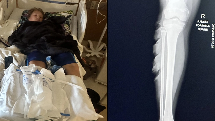 Mum feared son ’wouldn’t make it’ after having leg sucked into boat propeller in ‘horrifying’ accident
