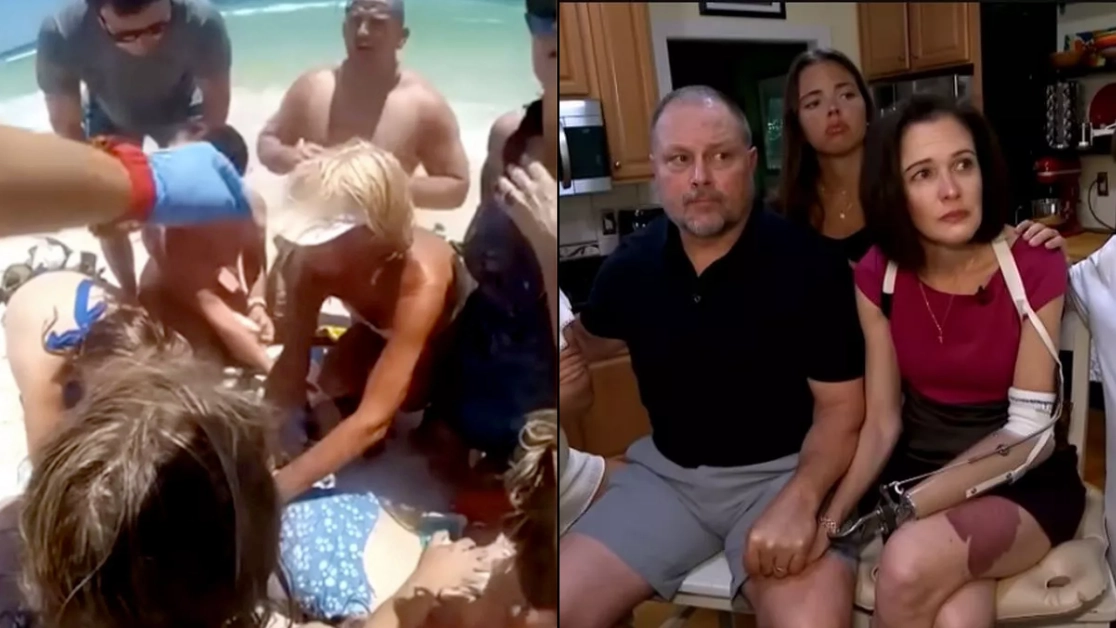 Shark attack survivor described moment she saw 'dark mass' in water before it 'snapped her hand right off'