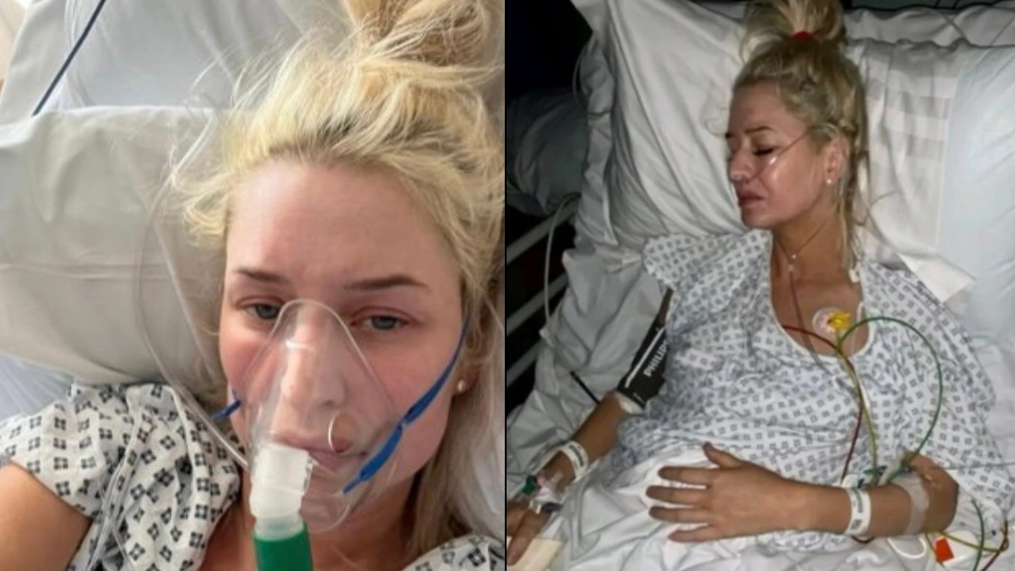 Woman issues warning after discovering 'long Covid' was instead flesh-eating disease that left her 'minutes from death'