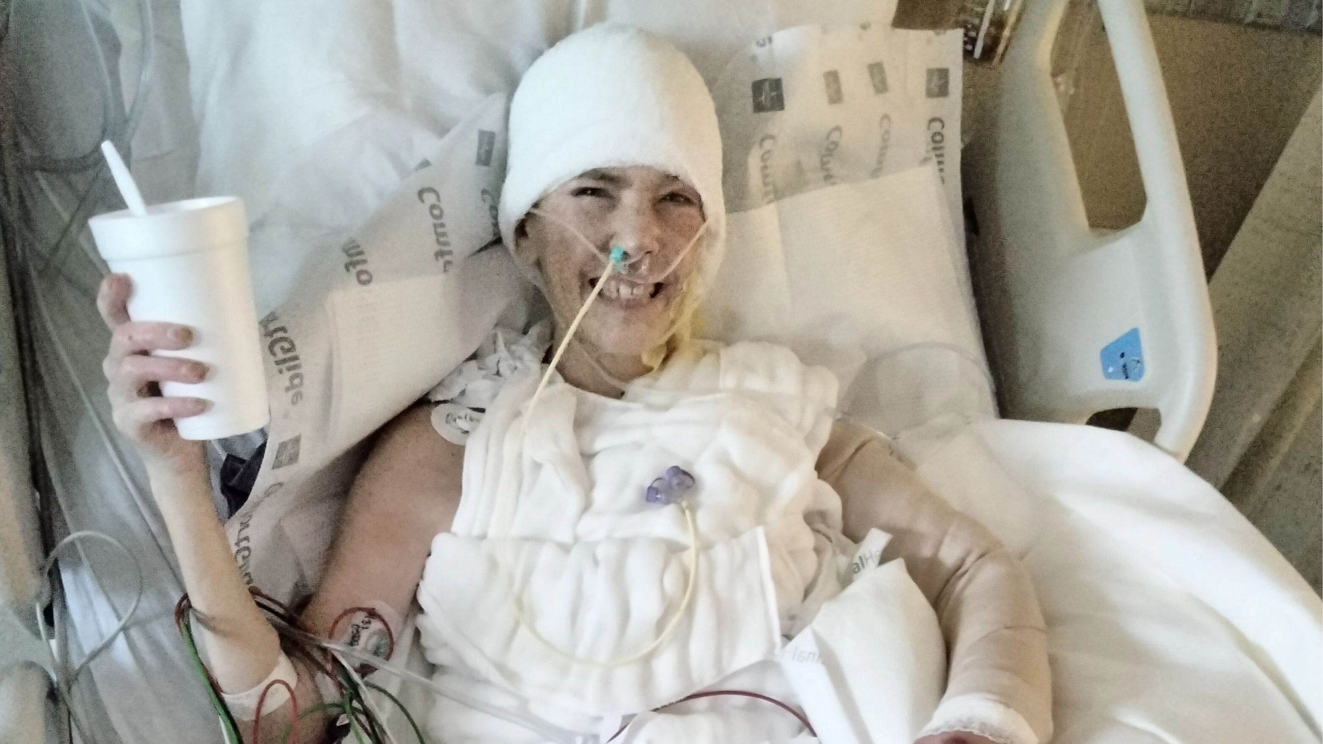 Woman who started smoking at eight issues stark warning after vape exploded and turned her into human fireball
