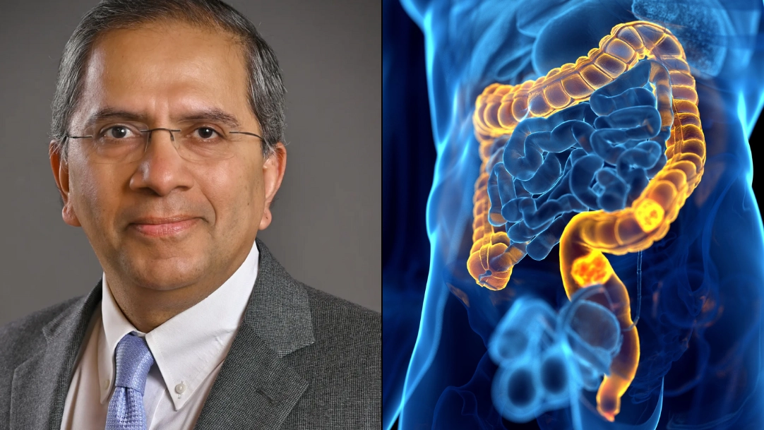 Surgeon gives patients one key piece of advice to help prevent colon cancer early as cases rise in under 50s