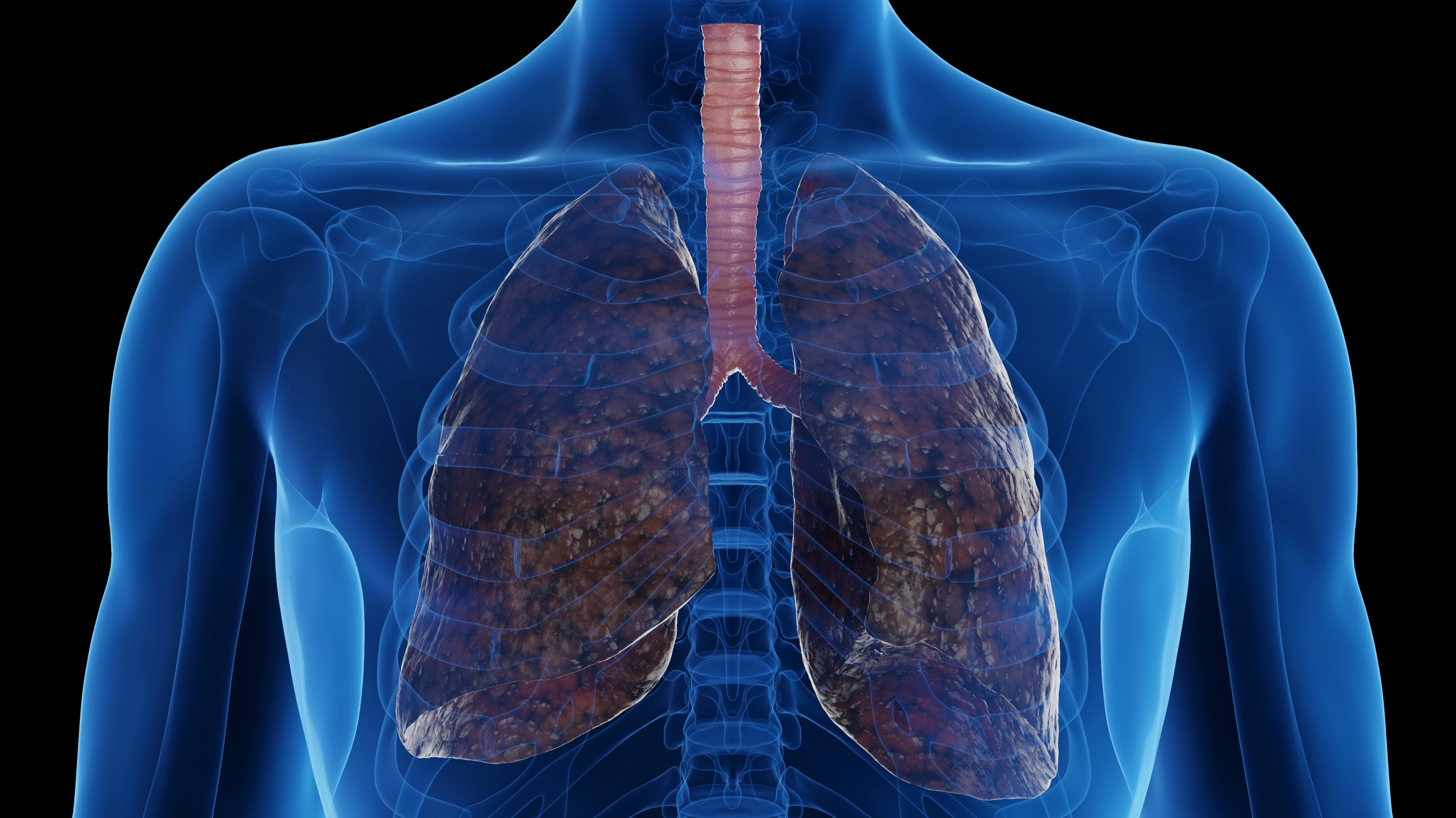 Concerning simulation shows true impact smoking has on your lungs