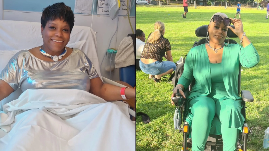Woman wakes up with ‘Italian accent’ after suffering from stroke despite never visiting the country