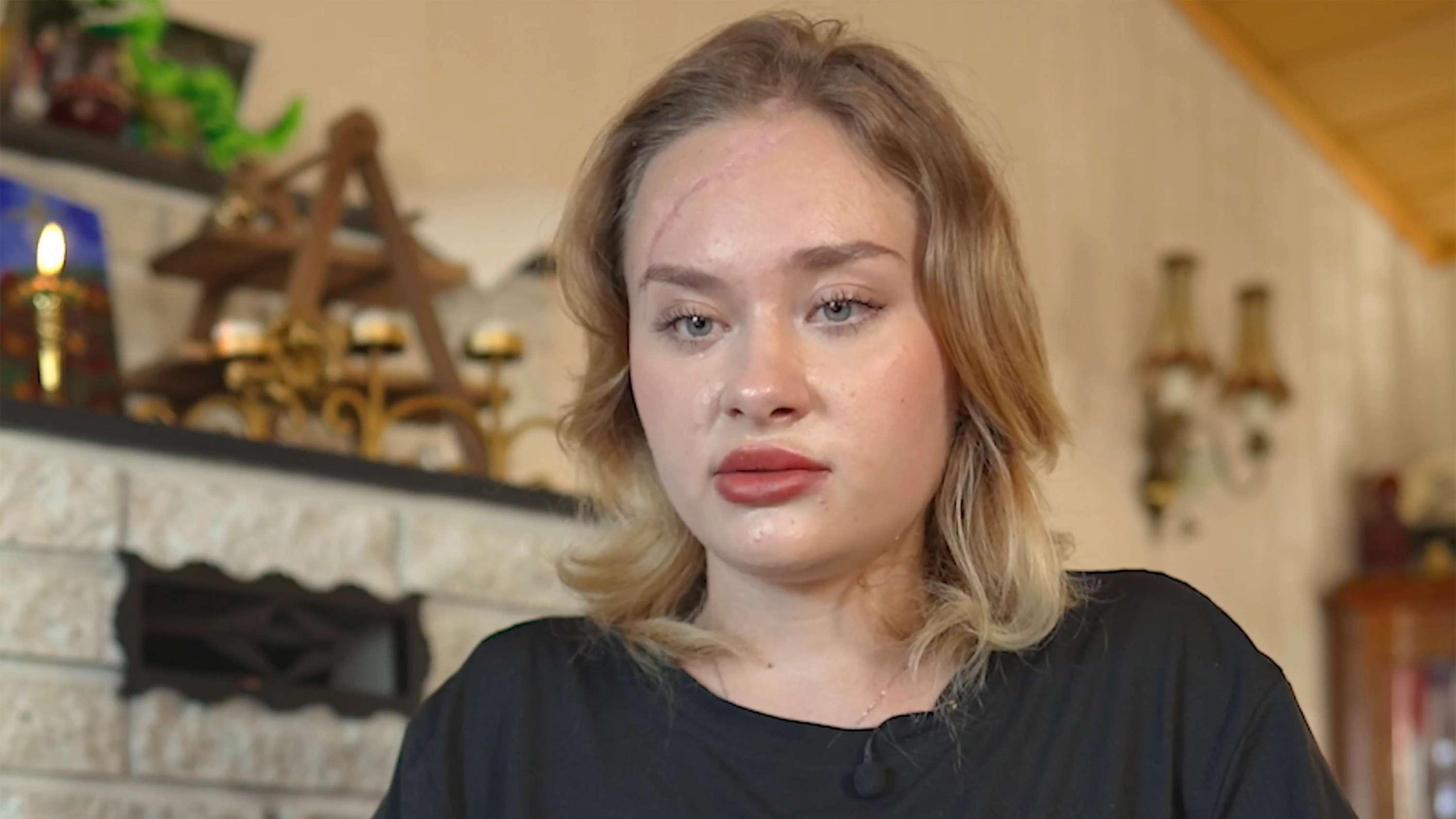 Model in coma for months after 'porta potty party' speaks out for first time