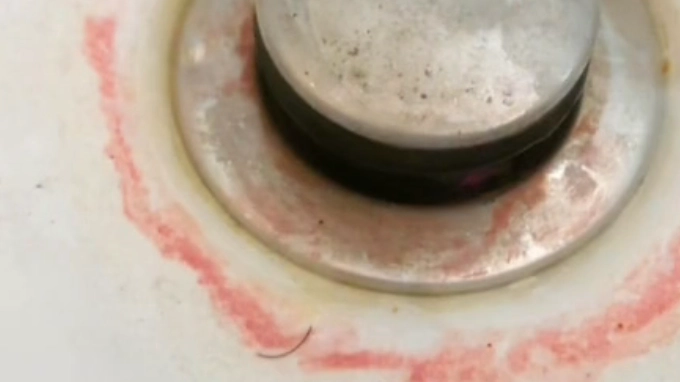 Doctor issues terrifying warning to anyone who finds 'pink slime' in their bathroom