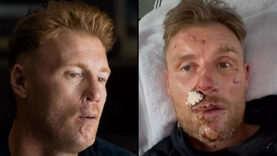 Freddie Flintoff speaks out on 'life-changing' Top Gear crash after showing horrific injuries for first time
