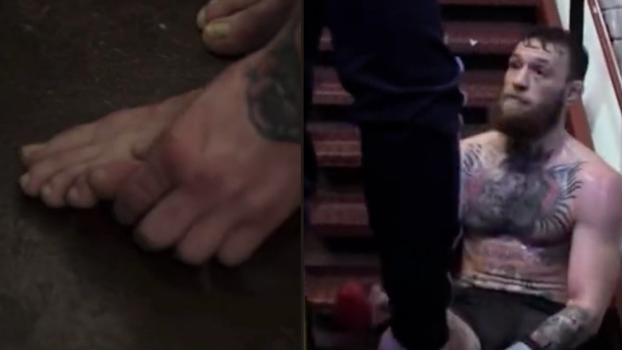 Netflix scene shows Conor McGregor dislocating toe before resetting it