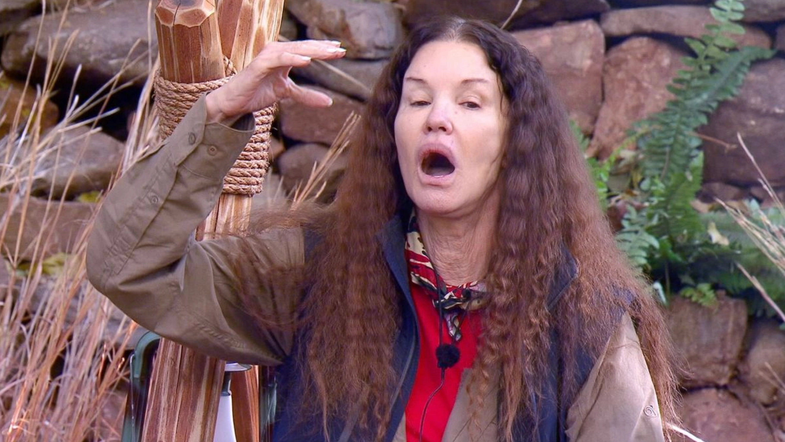 I’m a Celebrity contestant sues ITV for £700,000 after face is 'permanently altered' from injury