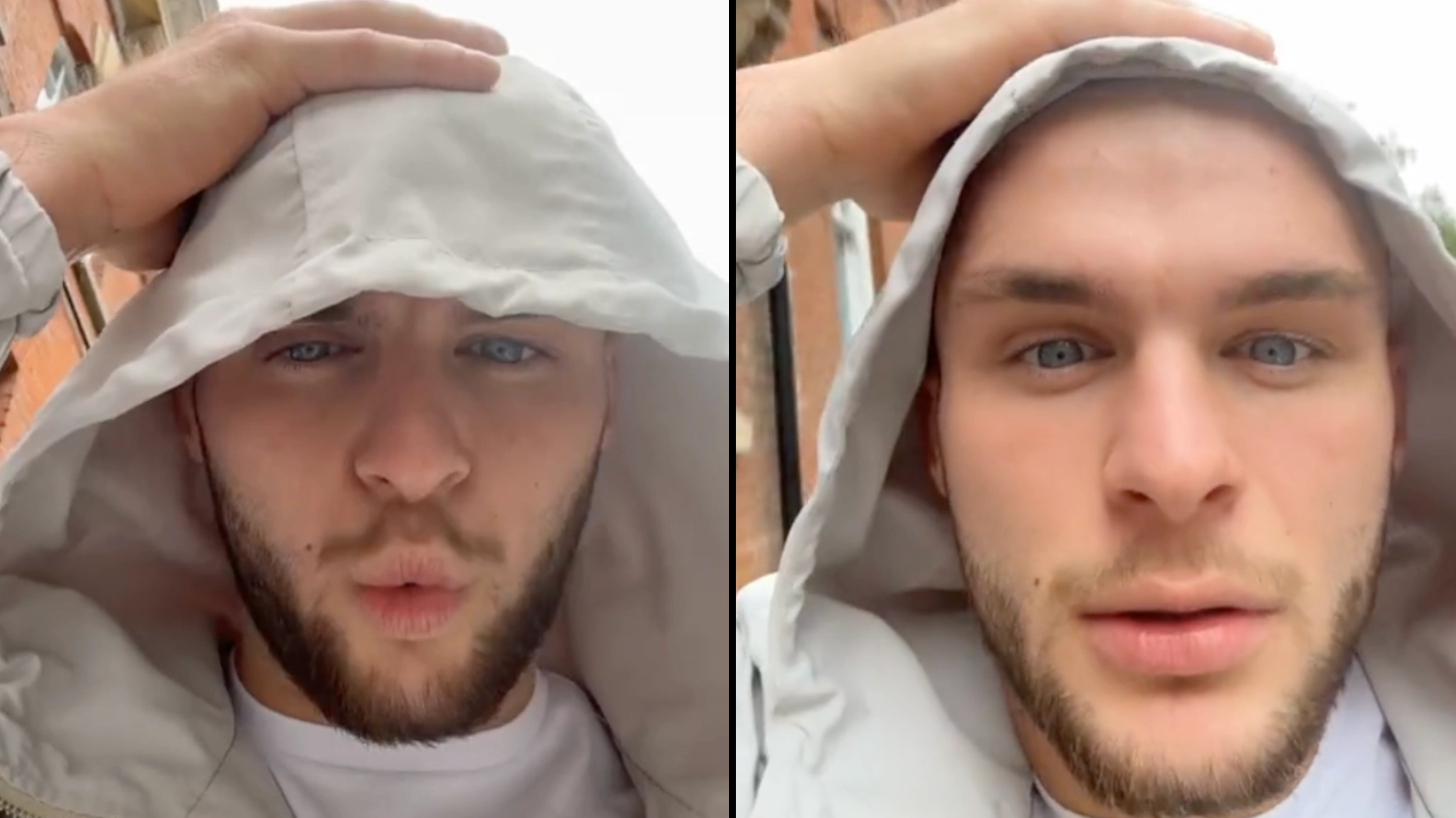 YouTuber furious after coming out of Turkish barbers with a brand new hairline