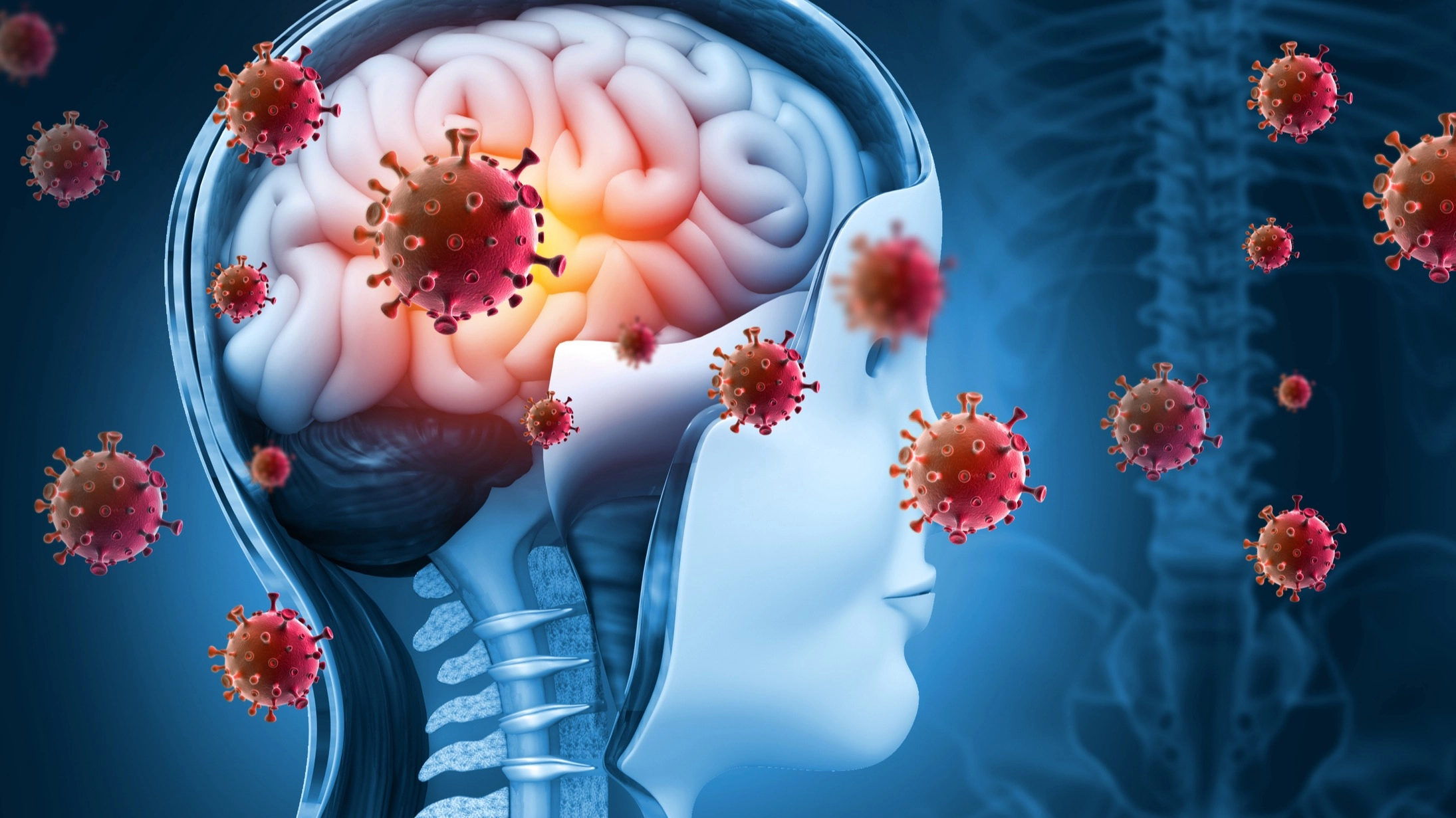 People most at risk of contracting meningitis as 'unprecedented' outbreak now a 'national incident'