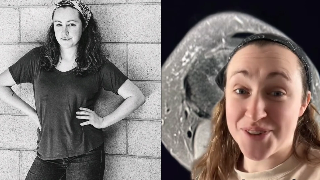 Woman issues warning after doctors dismissed ‘knee pain’ as sprain before being told she has a rare tumour