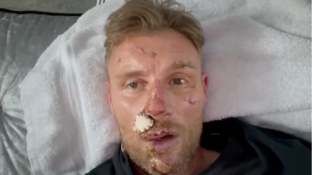 Freddie Flintoff makes heartbreaking admission about near-fatal Top Gear crash