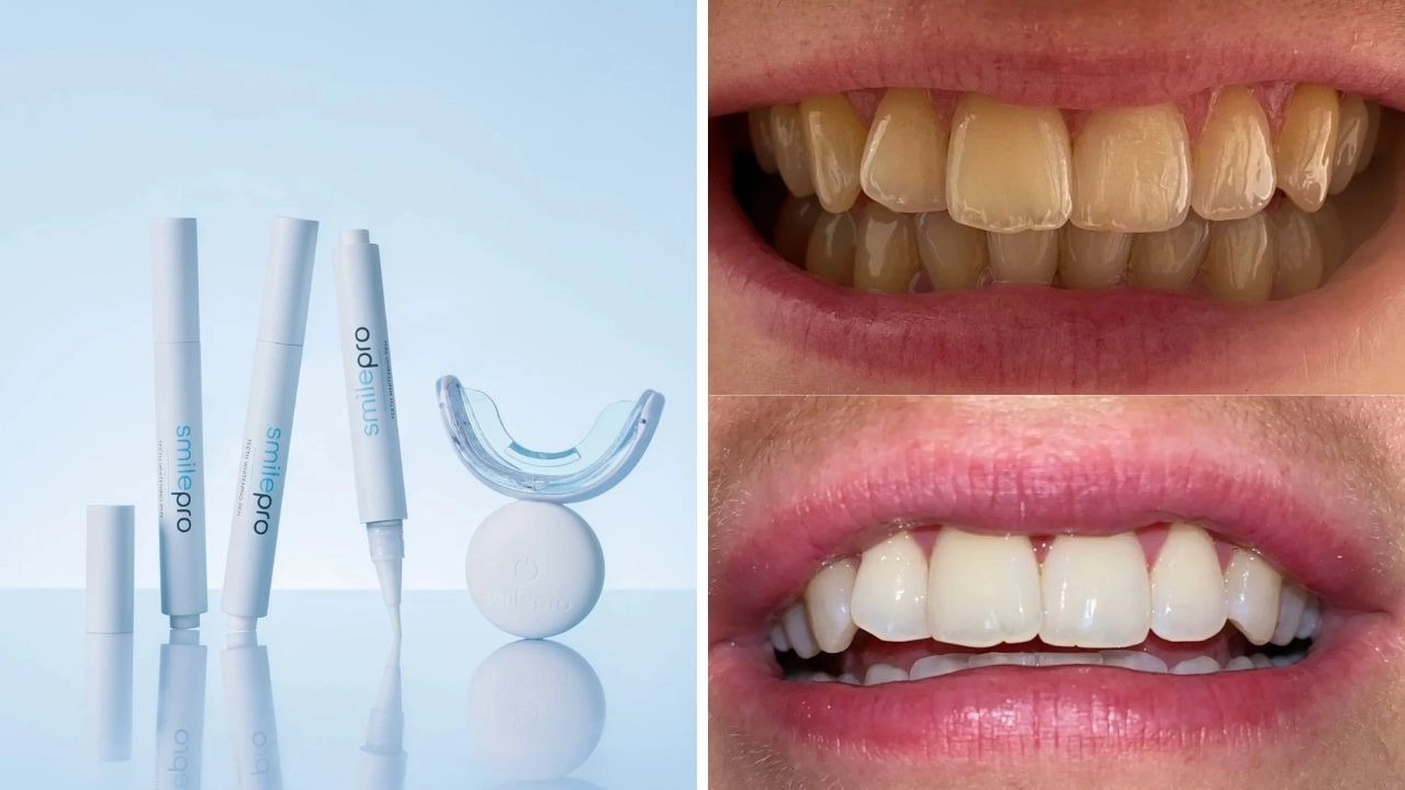 The SmilePro teeth whitening kit with thousands of five-star reviews is now 50% off