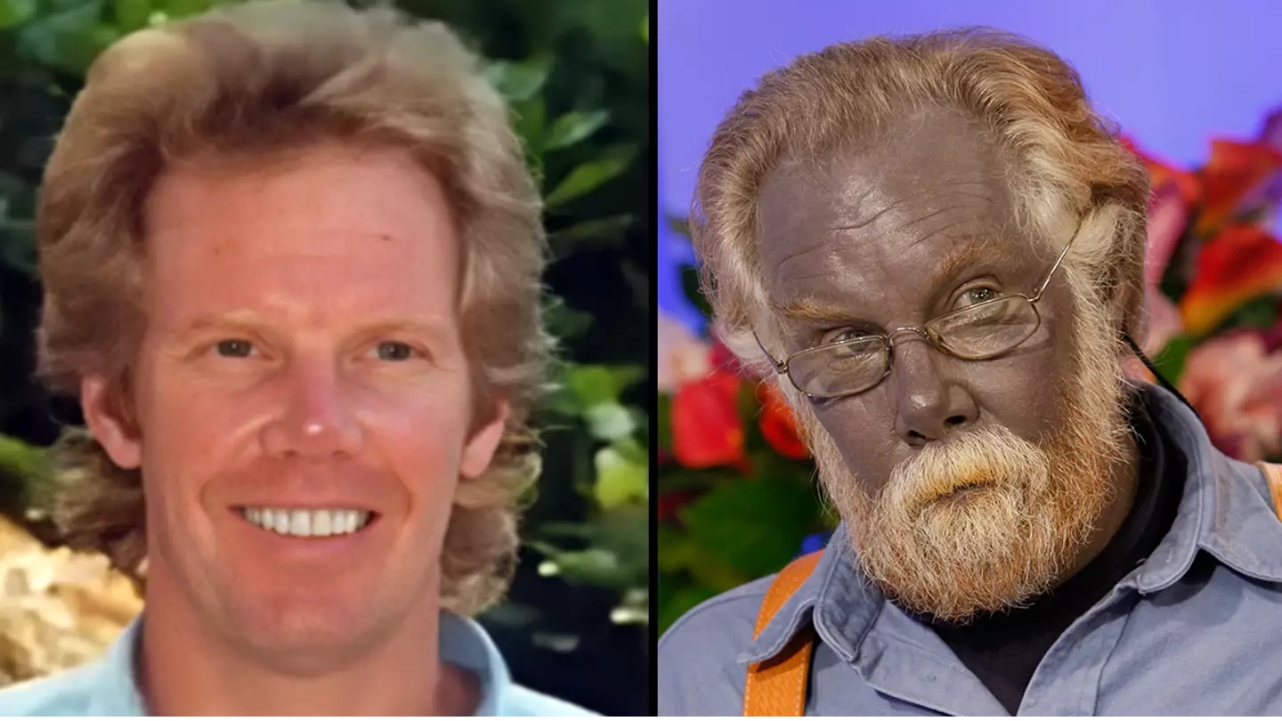 Strange case of the man who turned himself blue forever