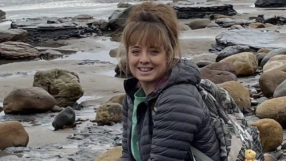 Woman covered up ‘ugly mark’ on her toenail with make-up only to find out it was sign of cancer