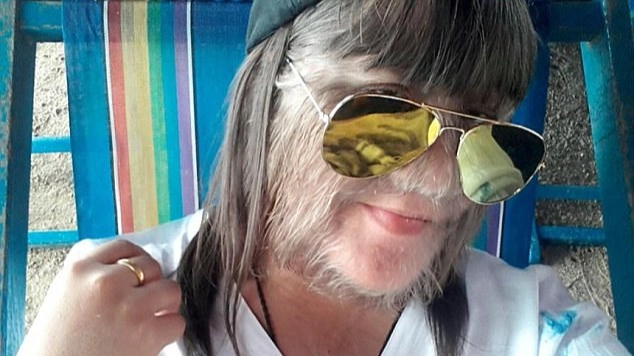 ‘World’s hairiest teenager’ shaved her face after becoming Guinness World Record holder