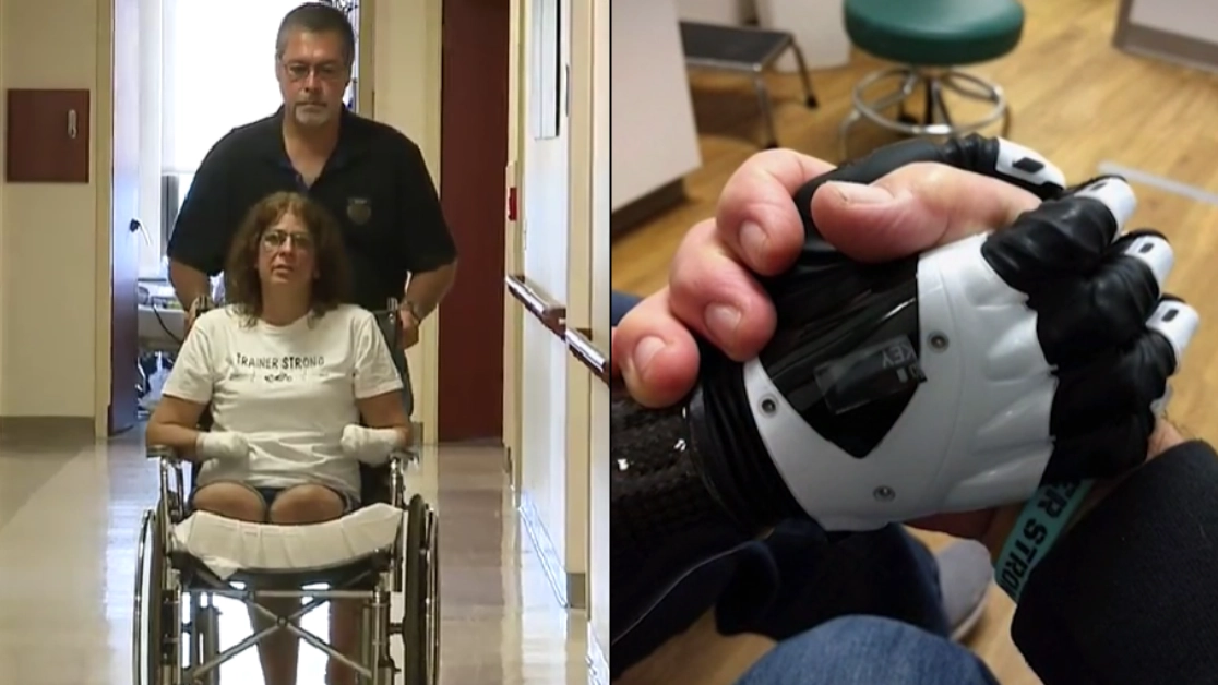 Woman lost all her limbs after 'normal' thing she did when walking into her house