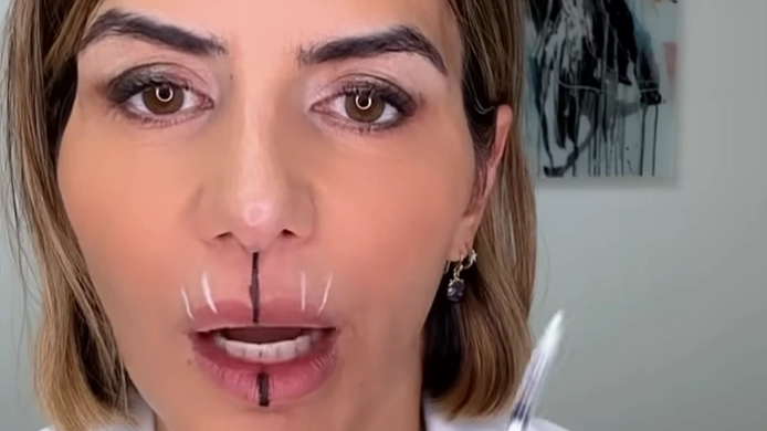 Doctor only injected one side of her mouth with botox to see how much of an impact it had