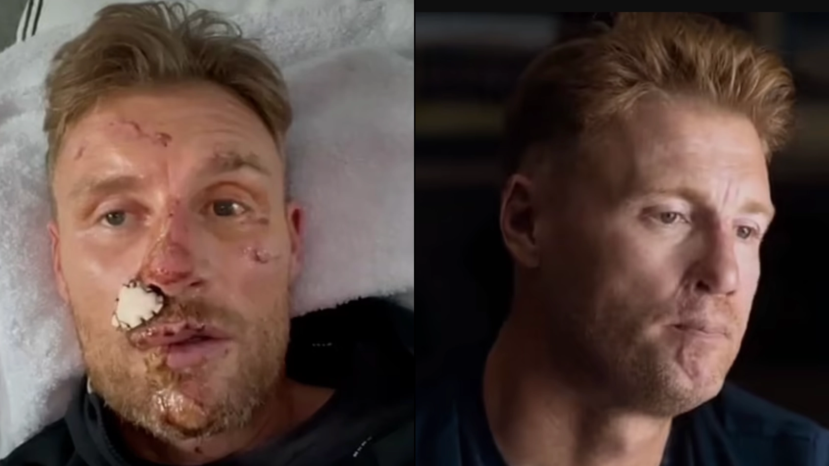 Freddie Flintoff's horrific crash injuries that forced him to quit Top Gear revealed for first time