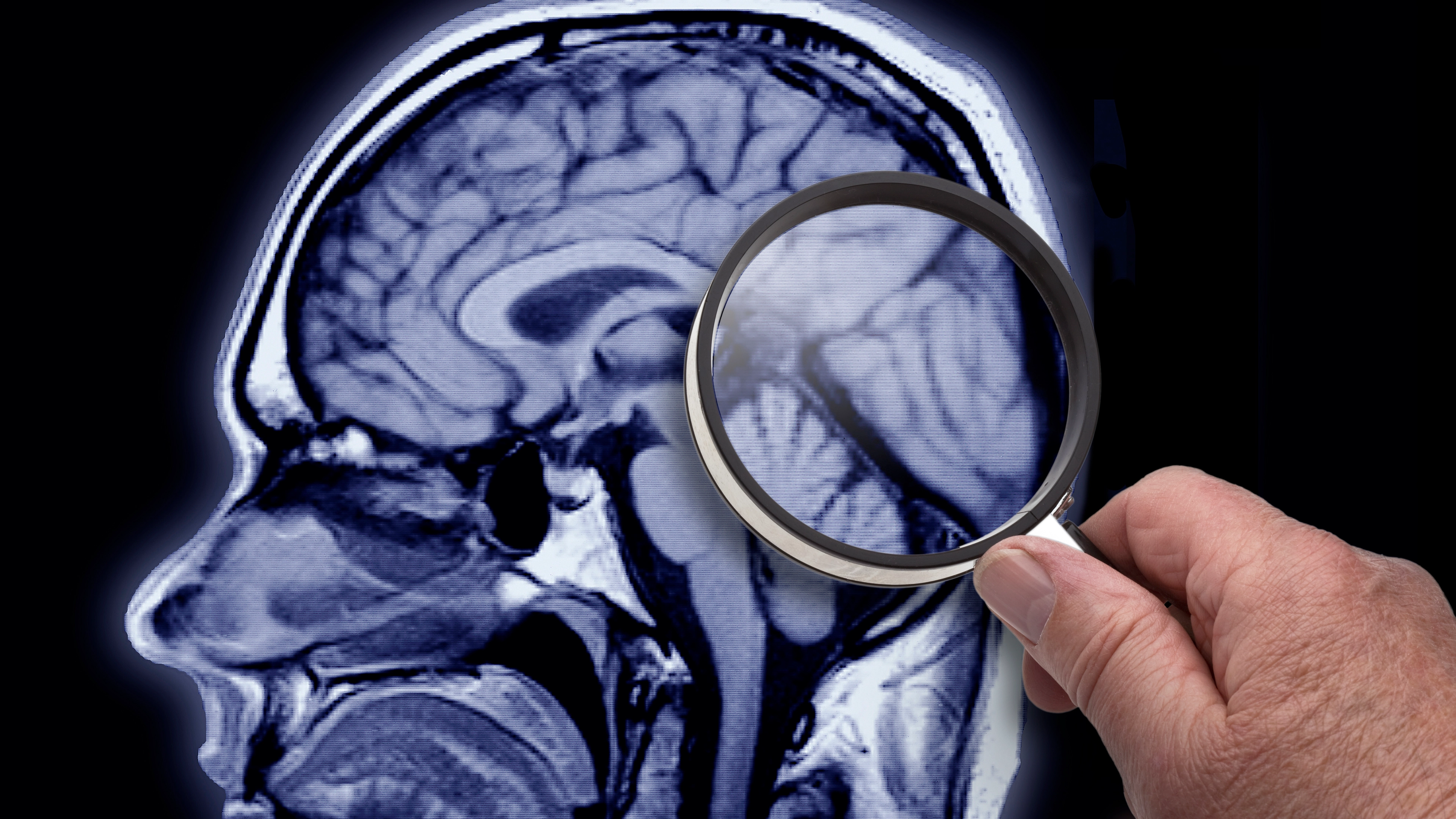 Scientists discover key sign you could be developing Alzheimer's disease