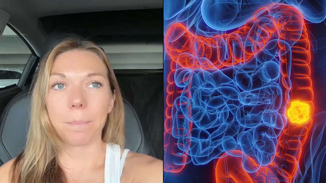 Woman diagnosed with hard-to-detect cancer shares key symptoms she had as cases soar among young people