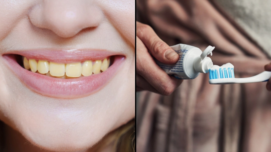 Dentist shares warning over common morning mistake that can lead to people’s teeth turning yellow