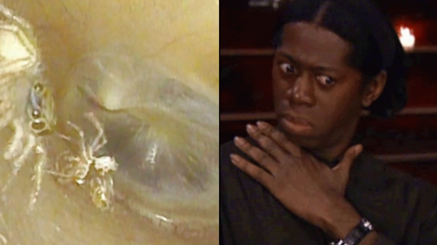 Doctors find spider crawling and shedding skin inside woman's ear