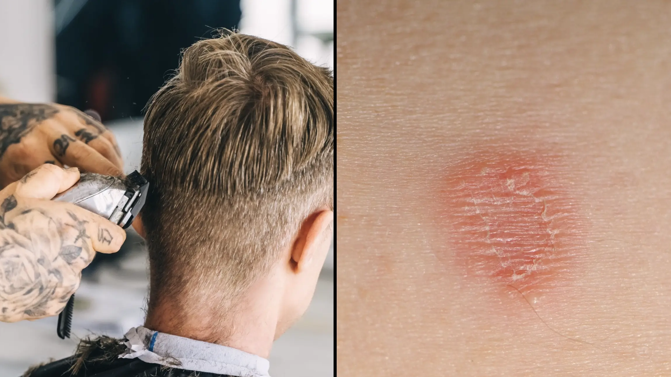 Urgent health warning issued to Brits who get skin fades at barbers