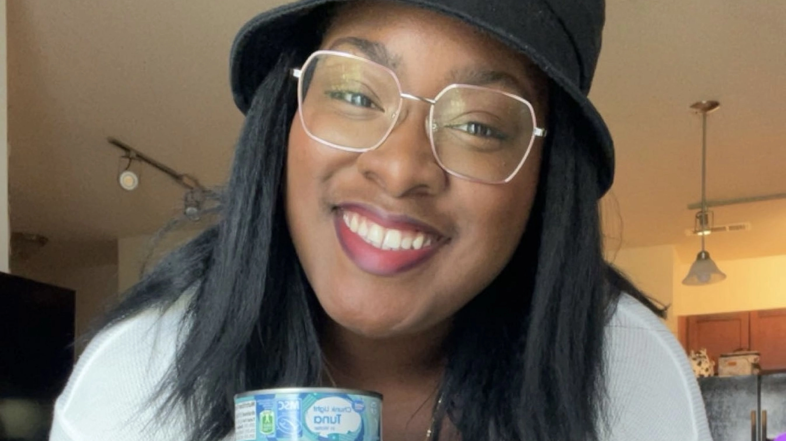 Woman issues warning to people who eats lots of tuna after being left with deadly poisoning 