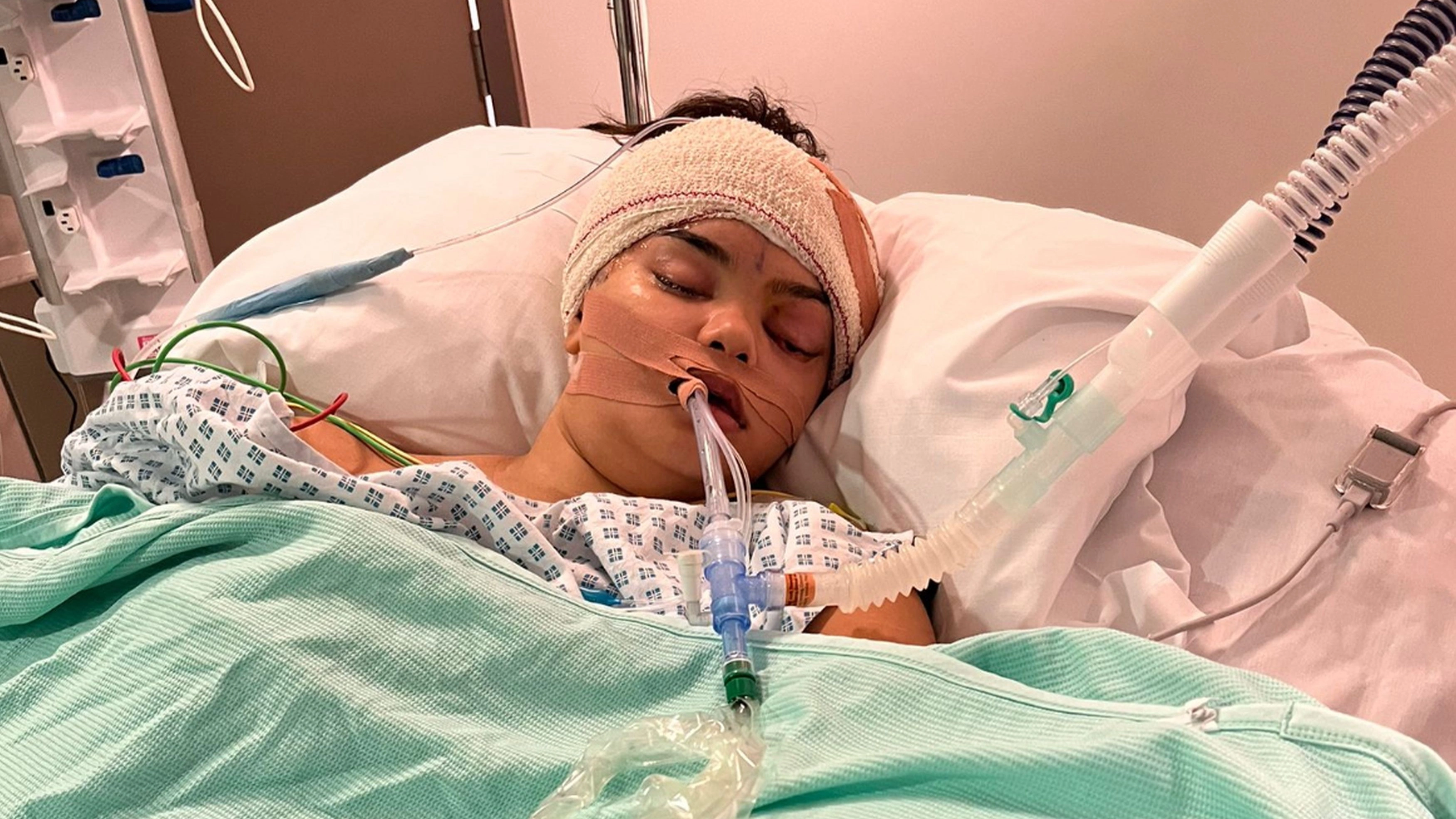 Woman horrified to discover why she was constantly rubbing her eye after going down with cold