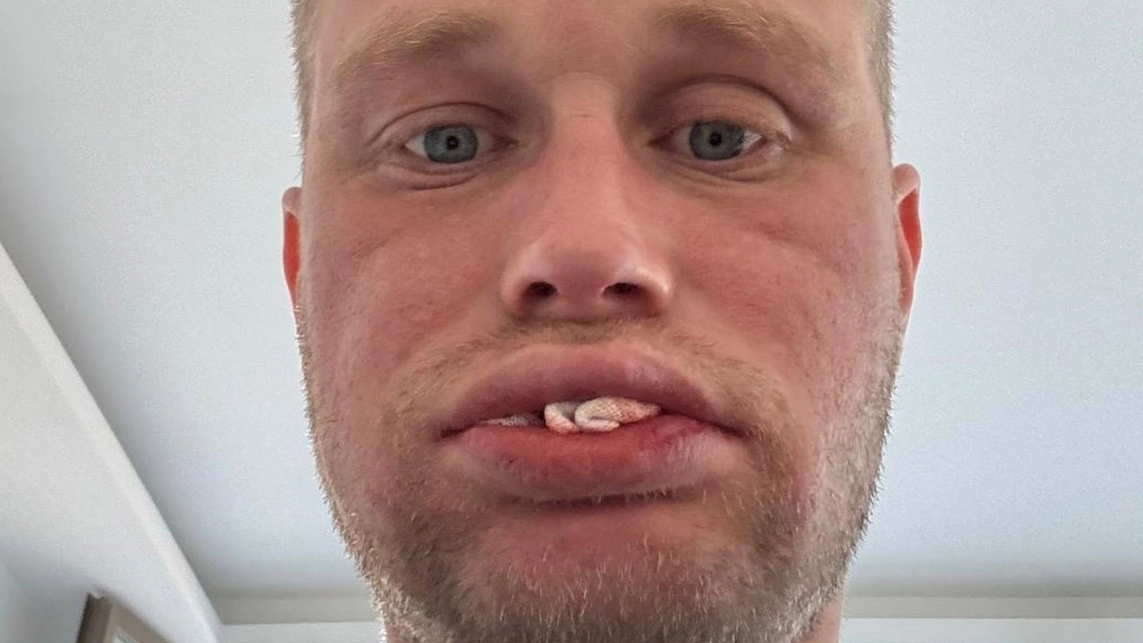 Man who spent £3,500 flying to Turkey for new teeth left with none at all