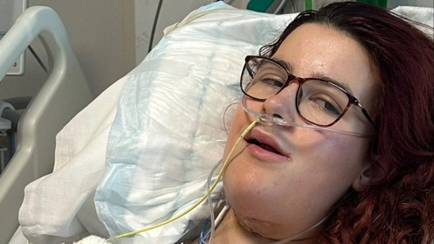 Woman woke up from surgery to find tattoo from her left arm now on tongue