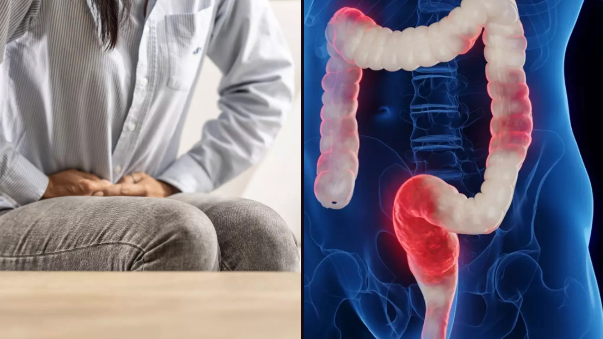 Scientists have made major breakthrough after searching for cause of inflammatory bowel disease