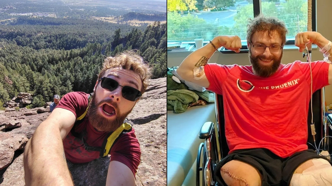 Man lost both legs minutes into first day in new job during freak accident that was 'miracle' he survived
