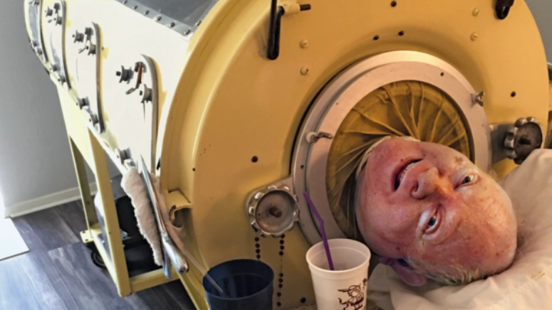 Man who lived in iron lung for 70 years until his death answered hugely common question on how he 'went to toilet'