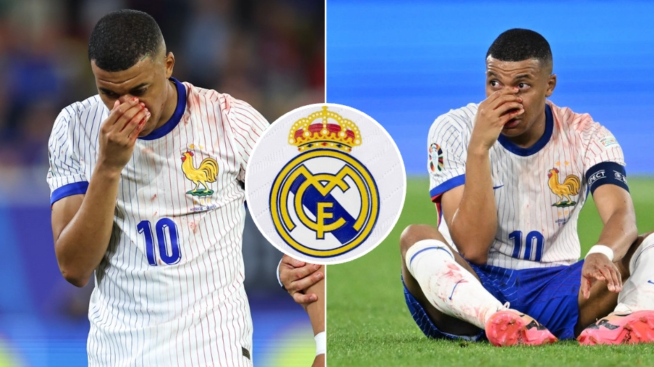 The bizarre reason why Real Madrid want to fast-track Kylian Mbappe's surgery for broken nose