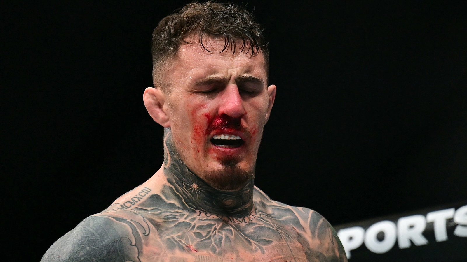 Tom Aspinall Has Three Options After Ciryl Gane Eye Poke Including Wildcard