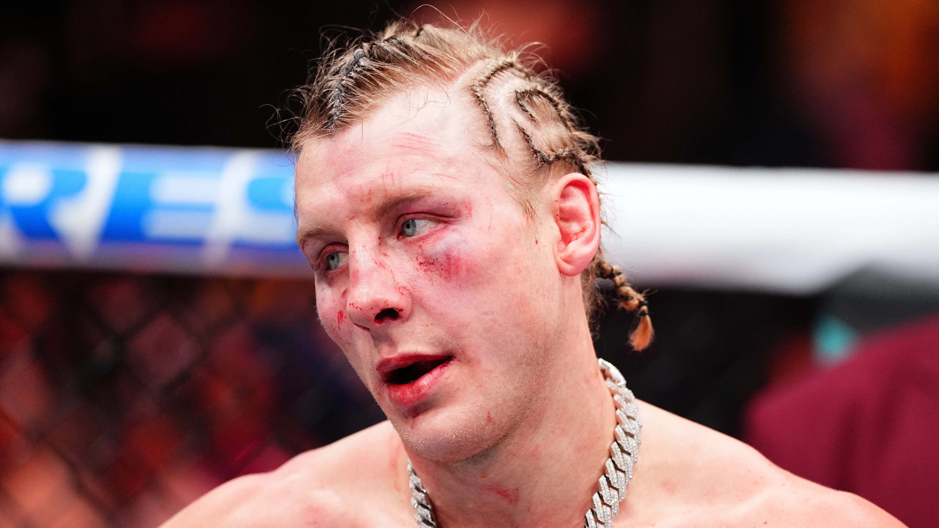 Paddy Pimblett Has Three Options After UFC 324 Defeat Including Huge Fight