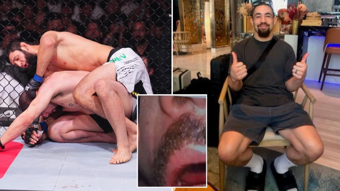 UFC fans are losing their minds after seeing the brutal aftermath of Khamzat Chimaev submitting Robert Whittaker 