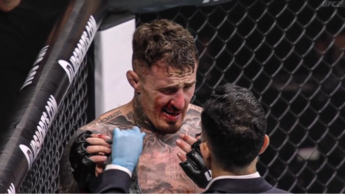 What Tom Aspinall Told Doctor Moments Before Stoppage vs Ciryl Gane at UFC 321