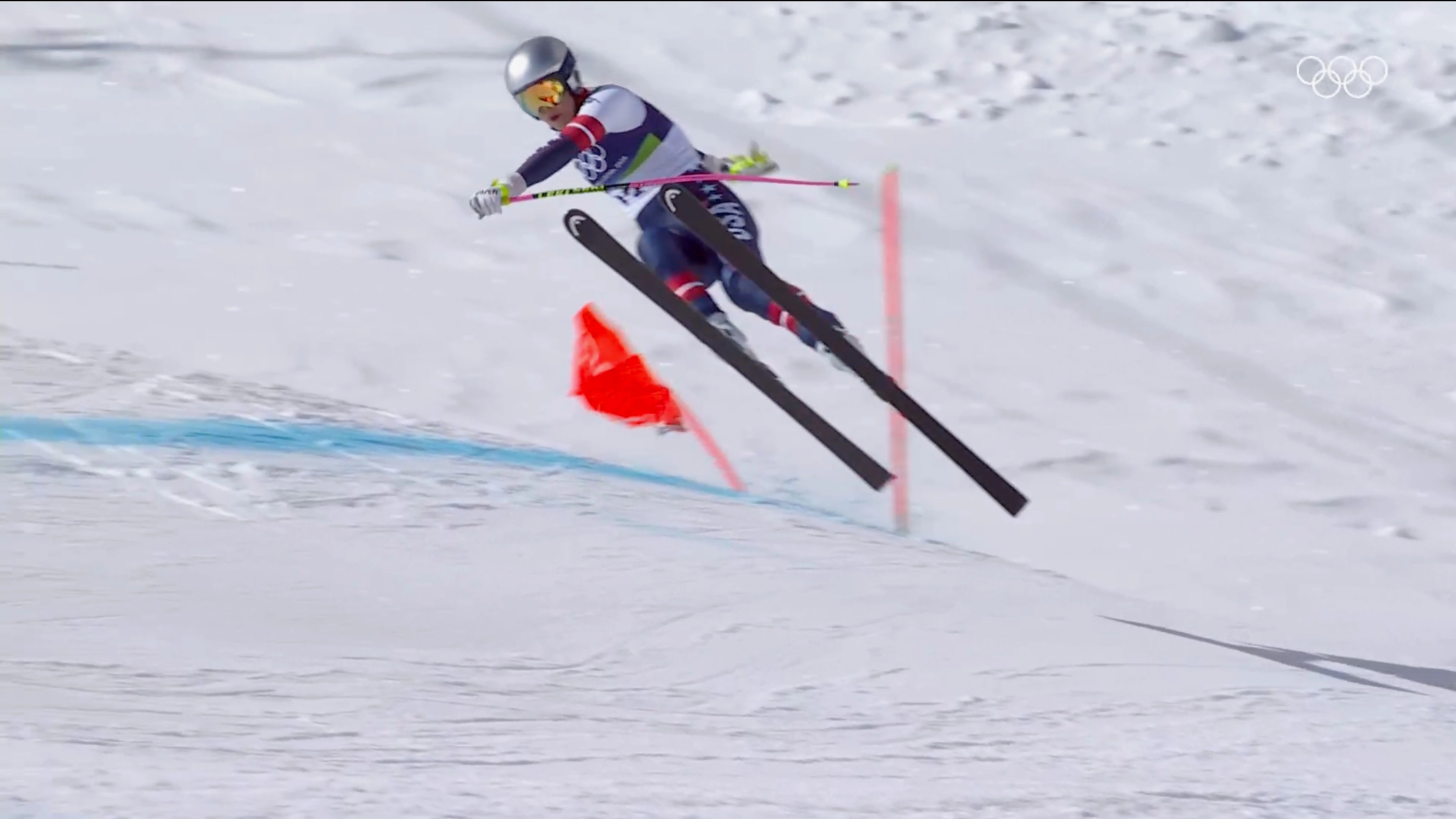 Lindsey Vonn Warned She Could Have Leg Amputated After Suffering Horror Injury