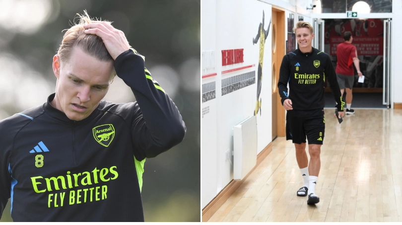Martin Odegaard missed Arsenal's last three games after being hit in the face with a ball in training