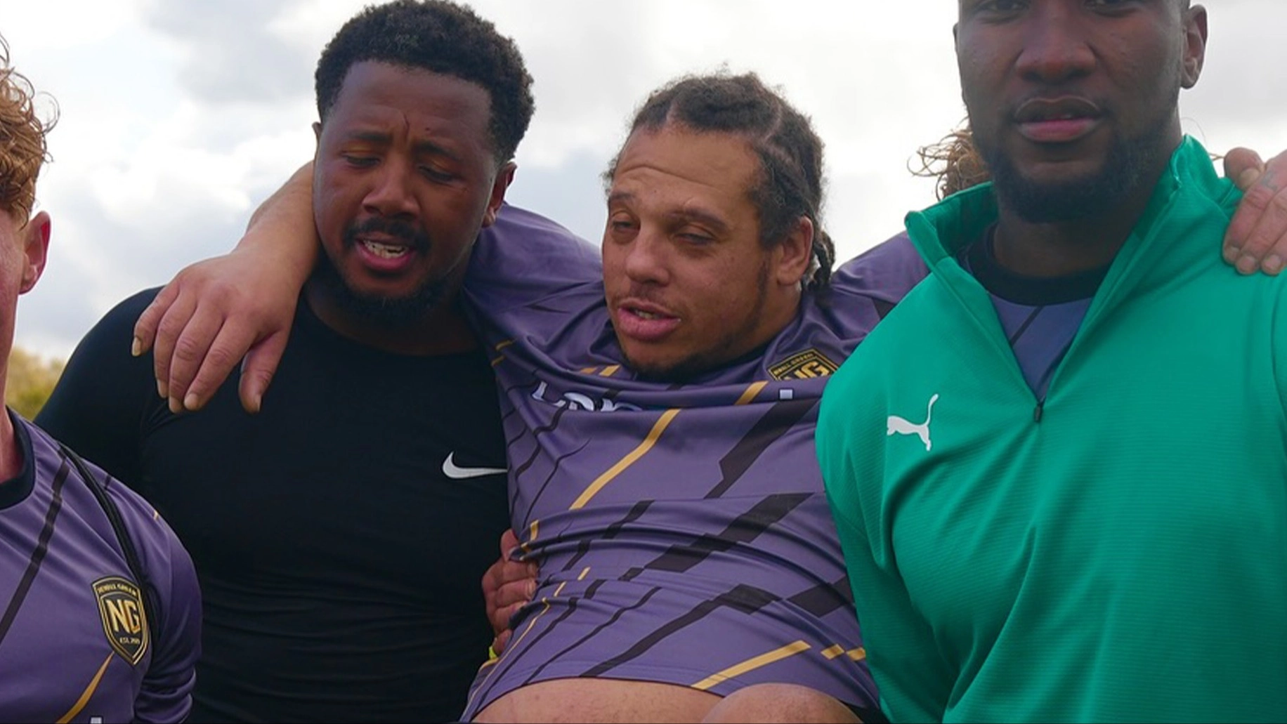 Sunday League Player Suffers 'Worst Injury Ever' as Gruesome Footage Goes Viral